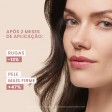 Avène Hyaluron Activ Procedure Creme Lifting 0.1% Retinal 30ml