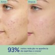 Caudalie Vinopure Fluido Matificante Hidratante 15ml
