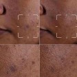 Clinique Even Better Clinical Dark Spot Clearing Serum 50ml