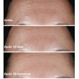 Clinique Smart Clinical Repair Wrinkle Correcting Serum 50ml