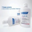 Ducray Kelual DS Intensive Tratamento Anticaspa 100ml