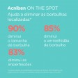 ISDIN Acniben On The Spot 15ml