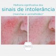 Neostrata Restore Sérum Antivermelhidão 29g