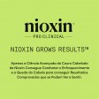 Nioxin Sistema 2 para Cabelo Natural com Perda de Densidade Avançada Pack XXL