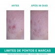 Uriage Hyséac 3-Regul+ Cuidado Global Anti-Imperfeições 40ml